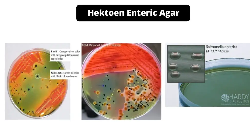 Hektoen Enteric Agar Composition Principle Preparation Results