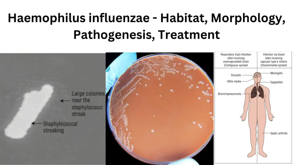 Haemophilus Influenzae Habitat Morphology Pathogenesis Treatment