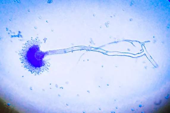 Lactophenol Cotton Blue (LPCB) Staining