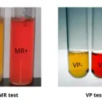Methyl Red and Voges Proskauer Test