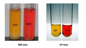 Methyl Red (MR) Test – Principle, Procedure, Results, Uses