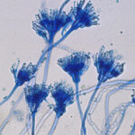 Lactophenol Cotton Blue Staining of aspergillus