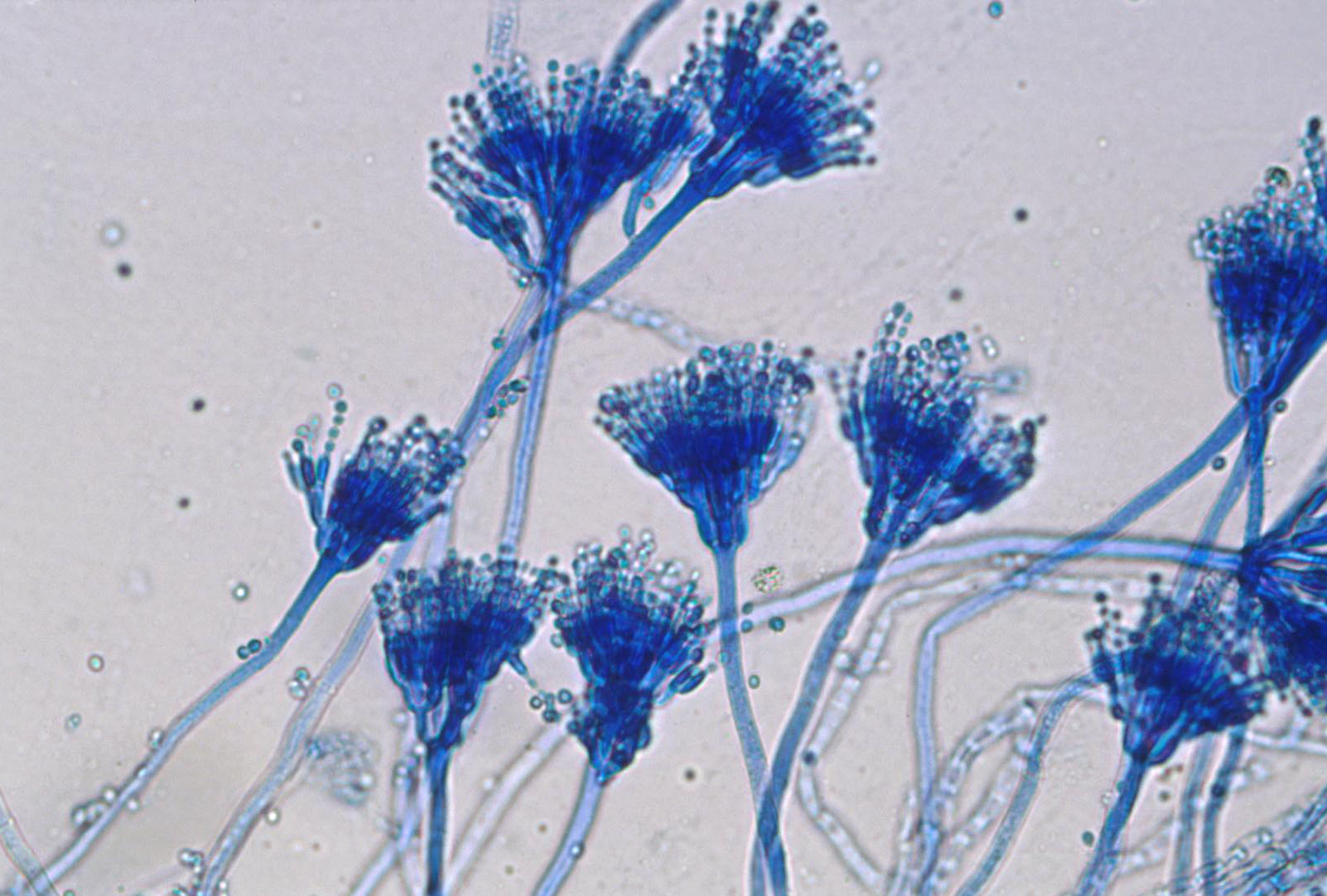 Lactophenol Cotton Blue Staining of aspergillus