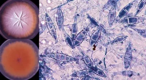 Microsporum spp. culture, infections, treatment, prevention.