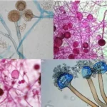 Study of Rhizopus by using Temporary Mount.