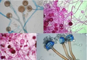 Study of Rhizopus by using Temporary Mount.