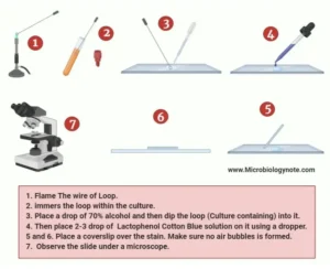 Study of Aspergillus by using Temporary Mount Technique