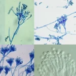 Study of Penicillium using Temporary Mount