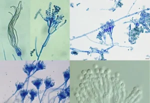 Study of Penicillium using Temporary Mount