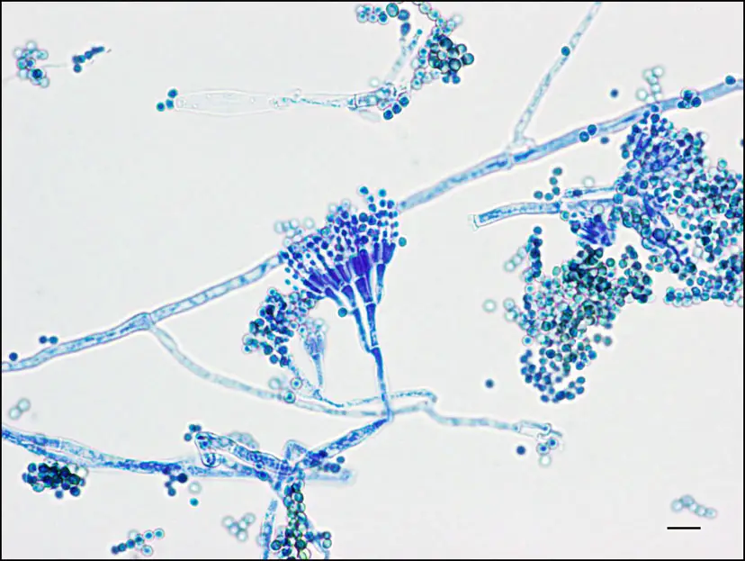 Study of Penicillium using Temporary Mount - Biology Notes Online