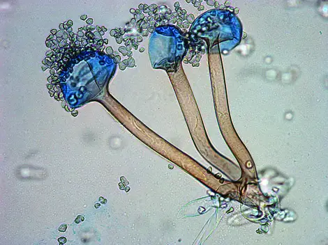 Study of Rhizopus by using Temporary Mount.