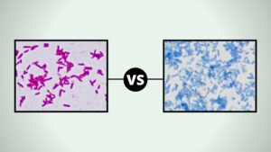 Comparison Between Acid Fast and Non Acid Fast Bacteria