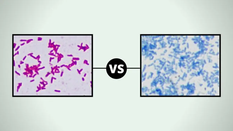 Comparison Between Acid Fast and Non Acid Fast Bacteria