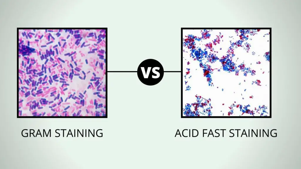 Comparison Between Gram Stain and Acid Fast - Biology Notes Online