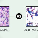 Comparison Between Gram Stain and Acid Fast