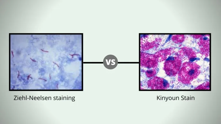 Comparison Between Kinyoun Stain vs Ziehl neelsen stain