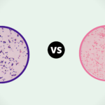 30 Comparison between Gram-Positive and Gram-Negative Bacteria
