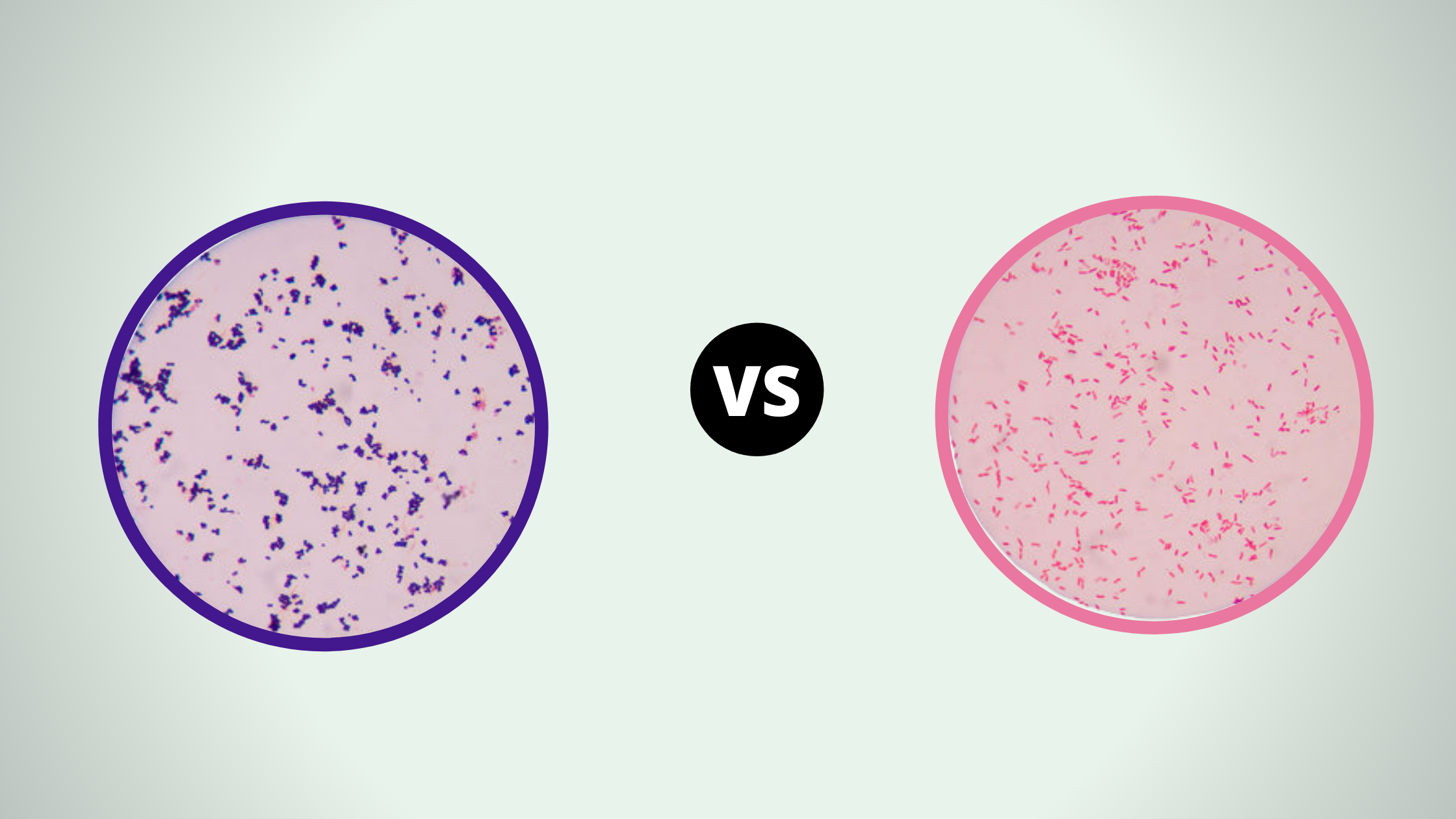 30 Comparison between Gram-Positive and Gram-Negative Bacteria