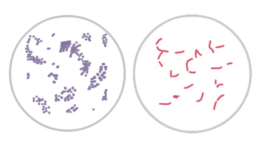 Gram Staining - Principle, Procedure, Results, Uses 2 Gram Staining