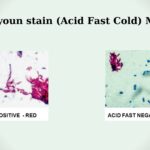 Kinyoun stain (Acid Fast Cold) Method: Principle, Procedure, Result