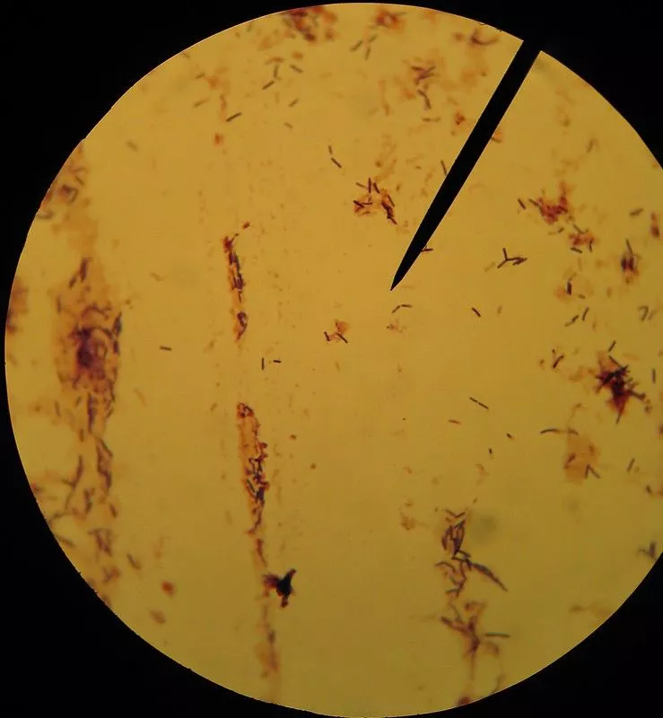 Gram Staining - Principle, Procedure, Results, Uses 23 Gram Staining Images