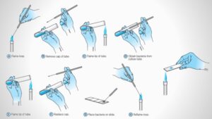 Bacterial Smear Preparation