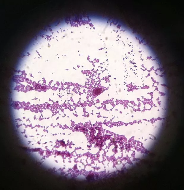 Gram Staining - Principle, Procedure, Results, Uses 24 Gram Staining Images