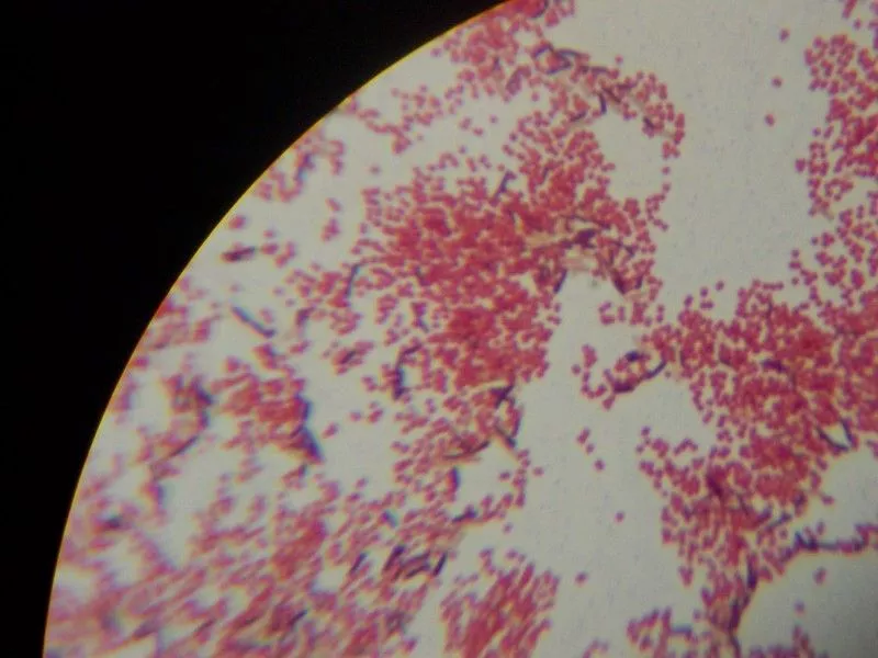 Gram Staining - Principle, Procedure, Results, Uses 22 Gram Staining Images