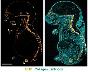 Result and interpretation of Collagen Hybridizing Peptide Staining