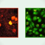 Acridine Orange Staining
