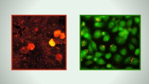 Acridine Orange Staining
