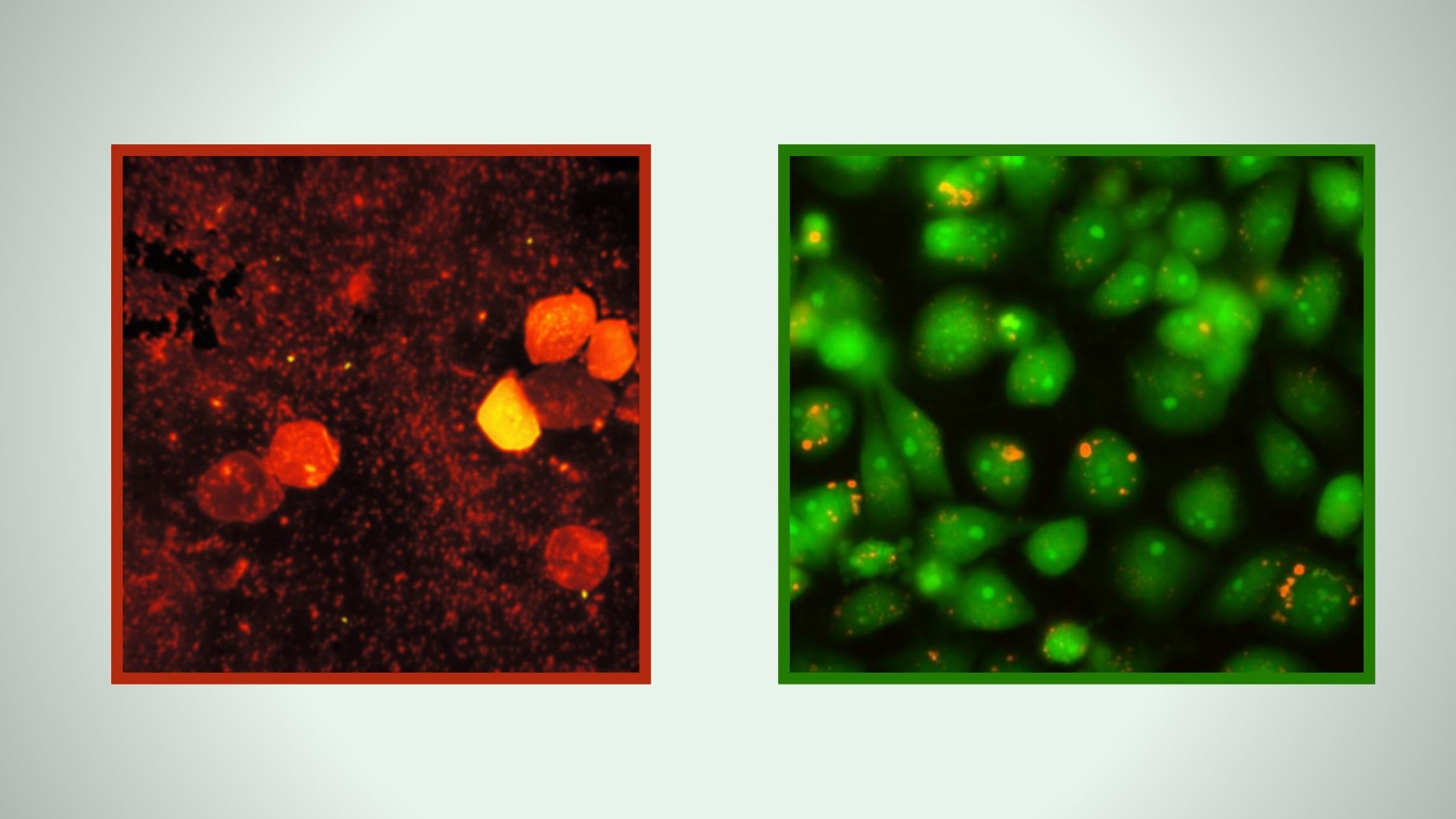 Acridine Orange Staining