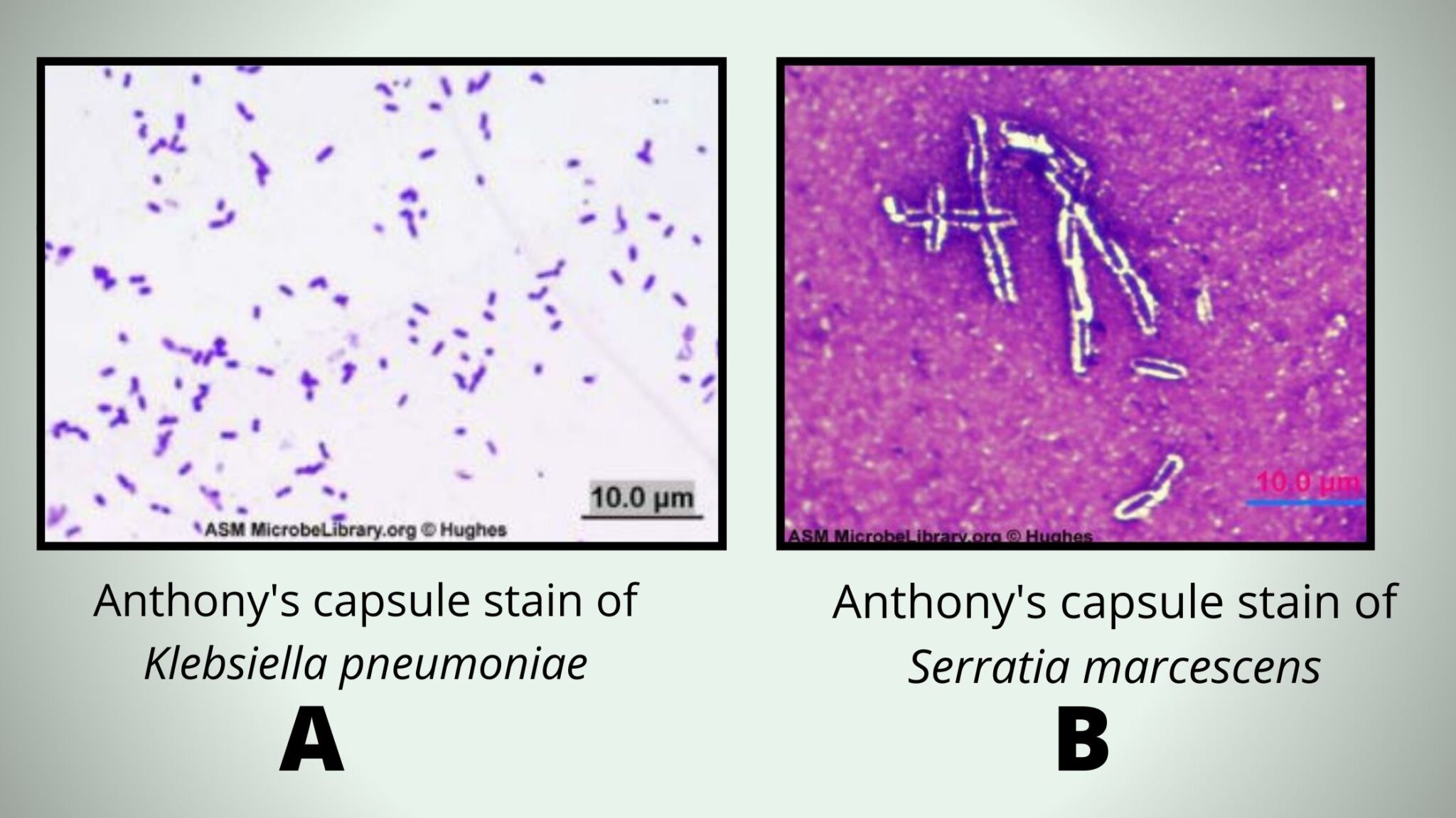 Capsule Staining Procedure, Principle, Result - Biology Notes Online