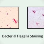 Bacterial Flagella Staining by Leifson Flagella Stain Method