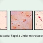 Flagella Staining Principle, Procedure, Result