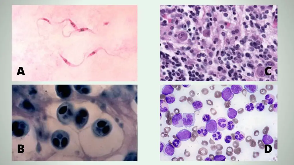 Giemsa Stain: Staining Procedure, Principle, Result and Application