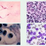 Giemsa Stain: Staining Procedure, Principle, Result and Application