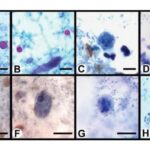 Iron-Hematoxylin Staining