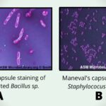 Maneval's capsule staining