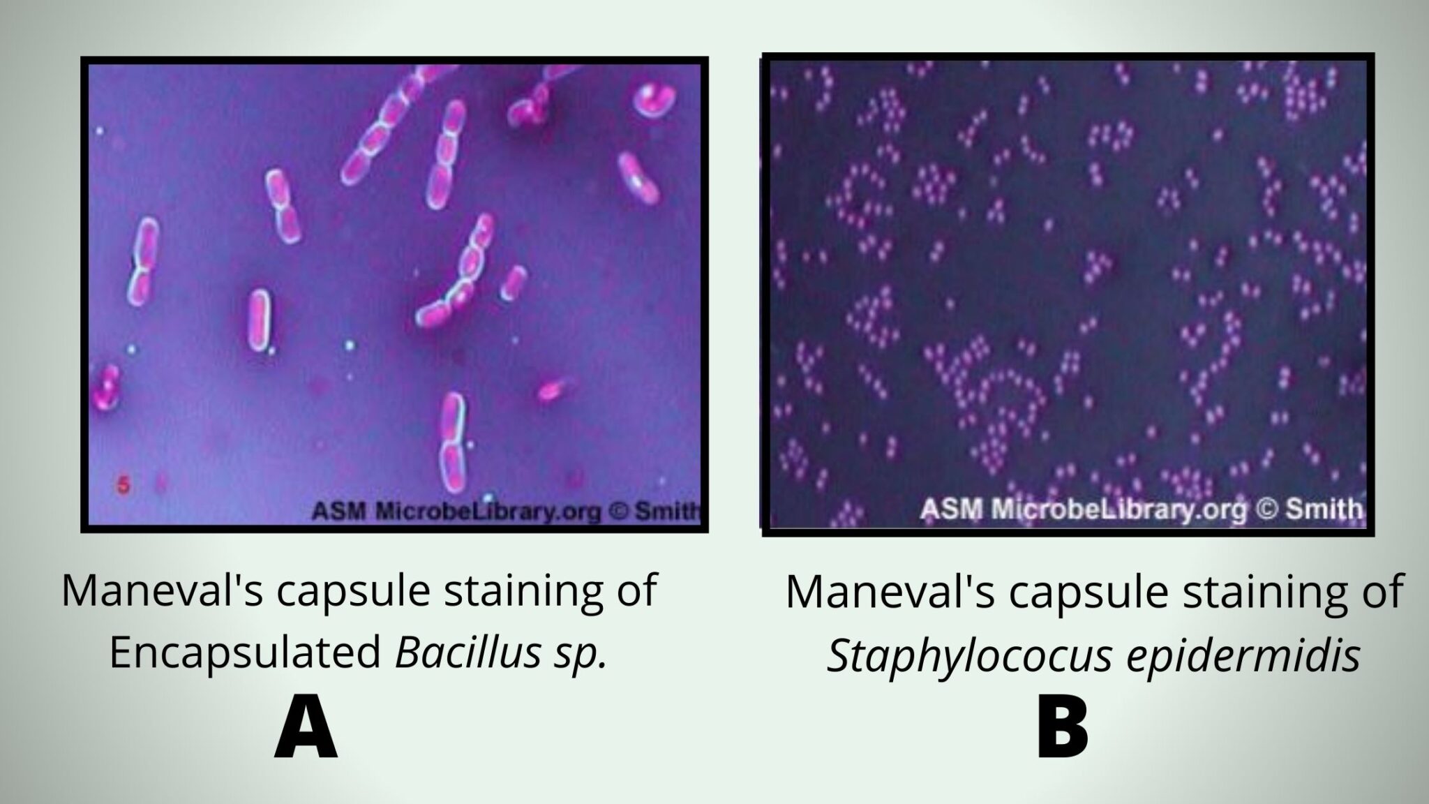 Capsule Staining - Procedure, Principle, Result - Biology Notes Online