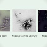Negative Staining result