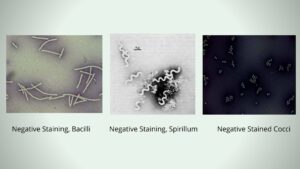 Negative Staining – Principle, Procedure, Result