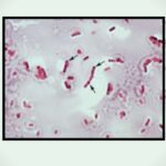 Parasporal Crystal Stain