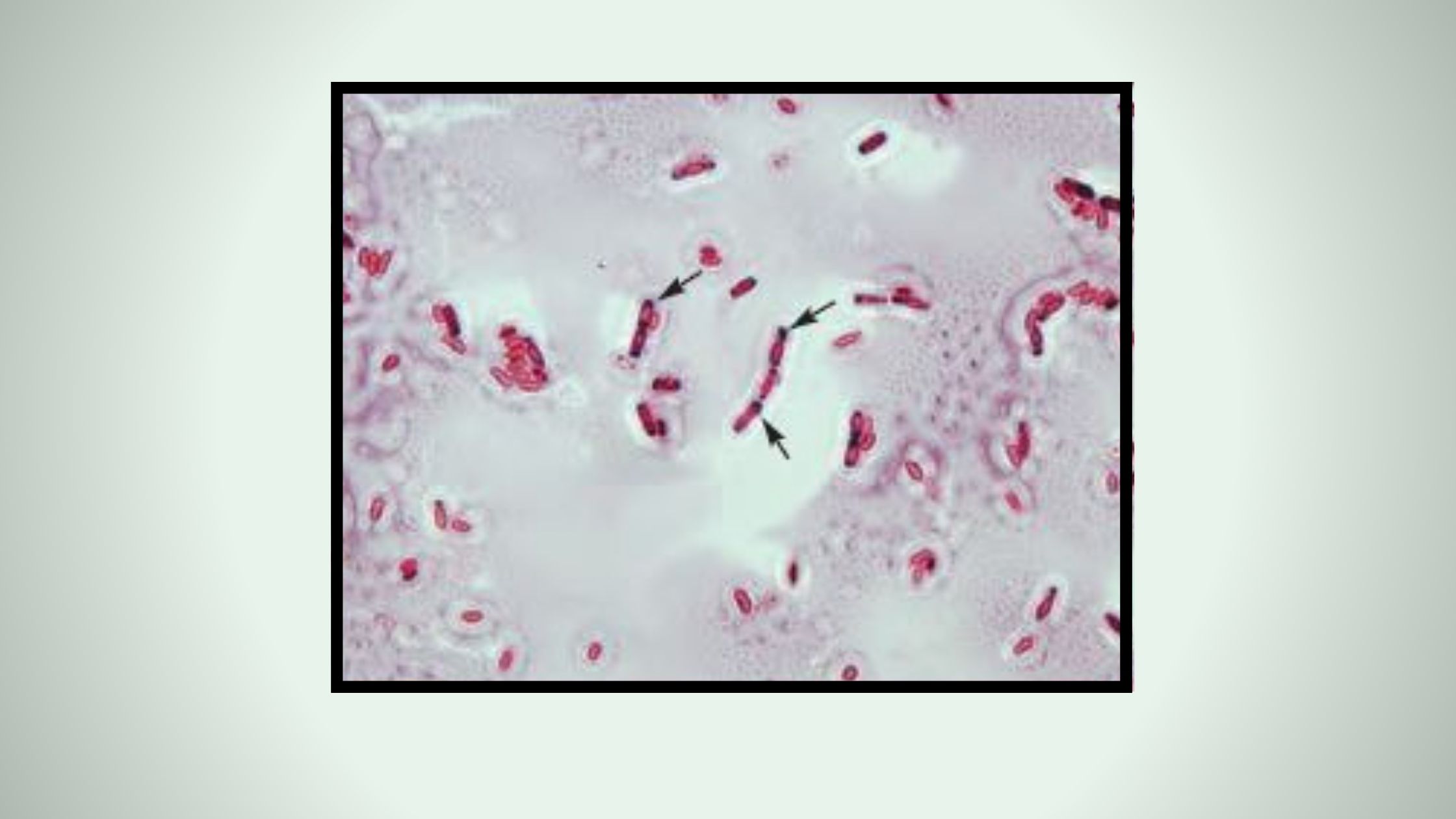 Parasporal Crystal Stain