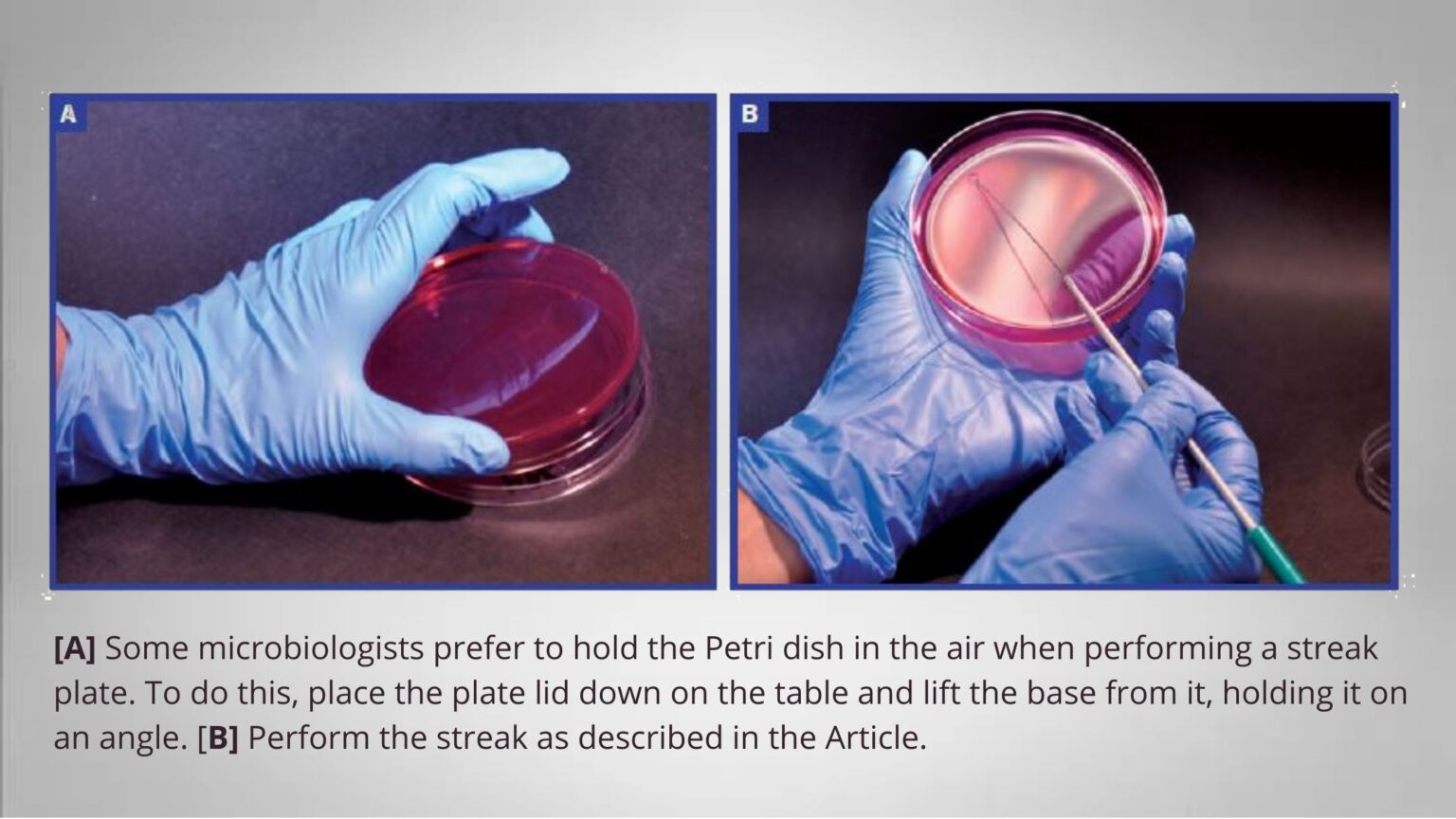 Streak Plate Method Patterns, Procedure, Principle Biology Notes Online