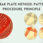 Streak Plate Method: Patterns, Procedure, Principle