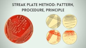 Streak Plate Method – Patterns, Procedure, Principle