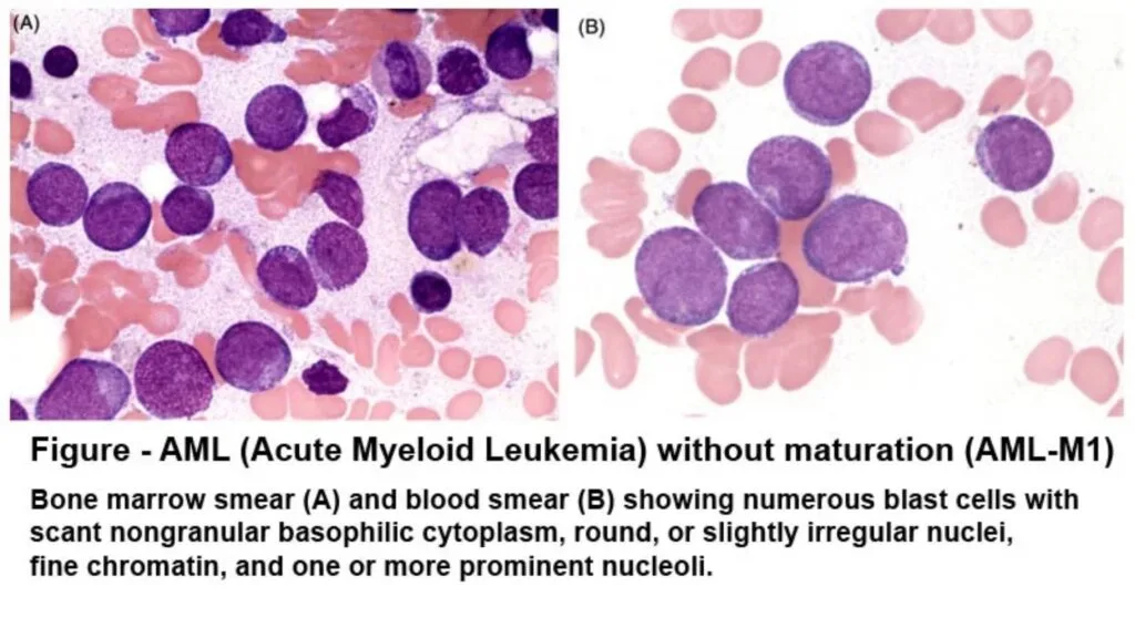 Sudan Black B Staining - Principle, Procedure, Uses 2 Sudan Black B Staining