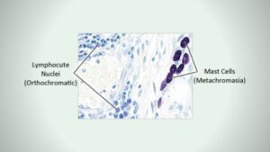Toluidine blue stain of Mast Cell