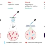 Endospore Staining Principle, Procedure, Result